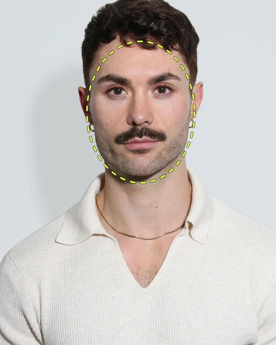 A patient photograph with the skin boosters area marked